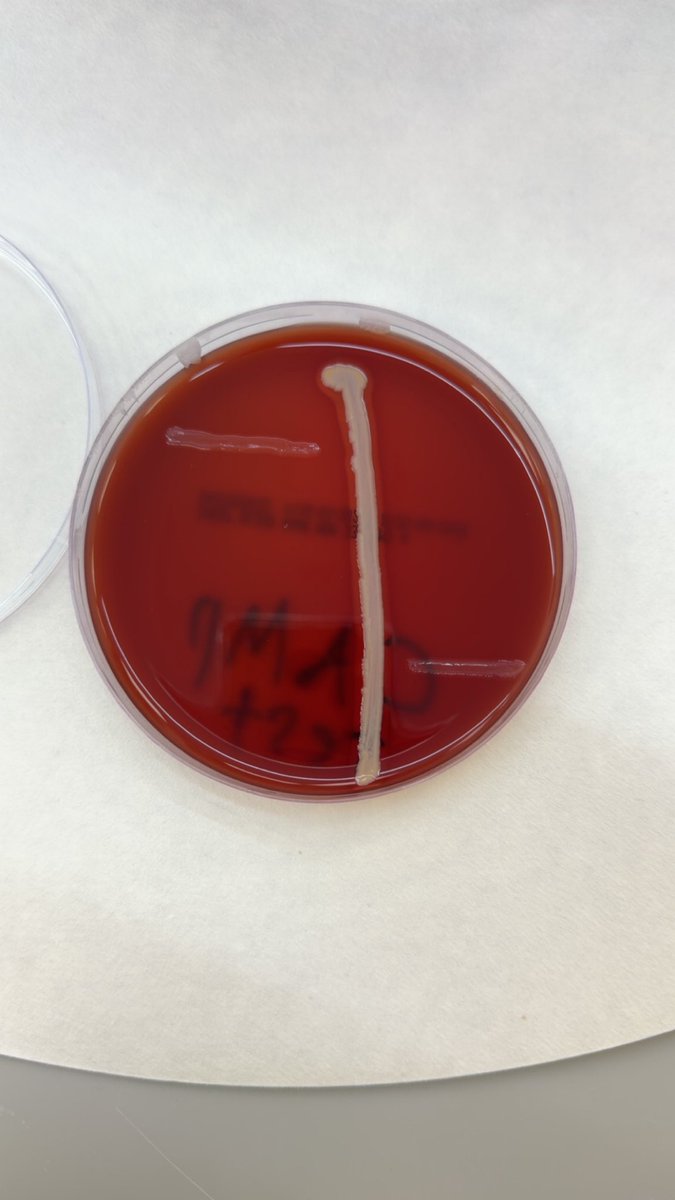 كنت انتظر ال Arrowhead يطلع