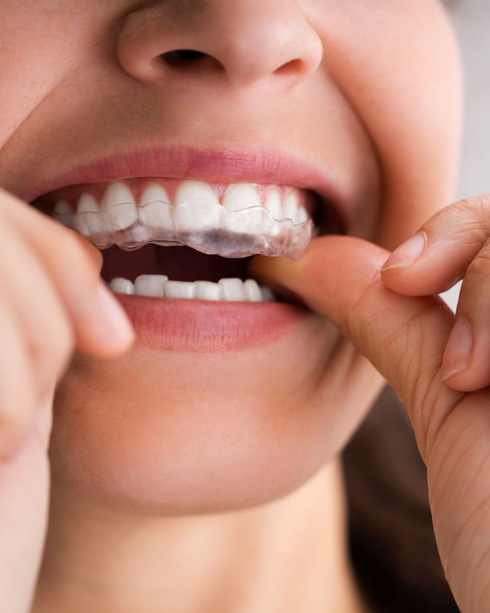 DoctoraSaraGil's tweet photo. ¿Sabías que los más pequeños también pueden comenzar un tratamiento de ortodoncia invisible? 🦷 https://t.co/H7JQKCucY4
