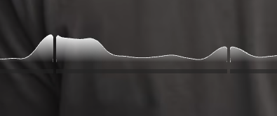 kan_duya's tweet photo. so YouTube for web has implemented a not-so-liquid-glass glass effect on their seek bar. https://t.co/19sSsaenQ4