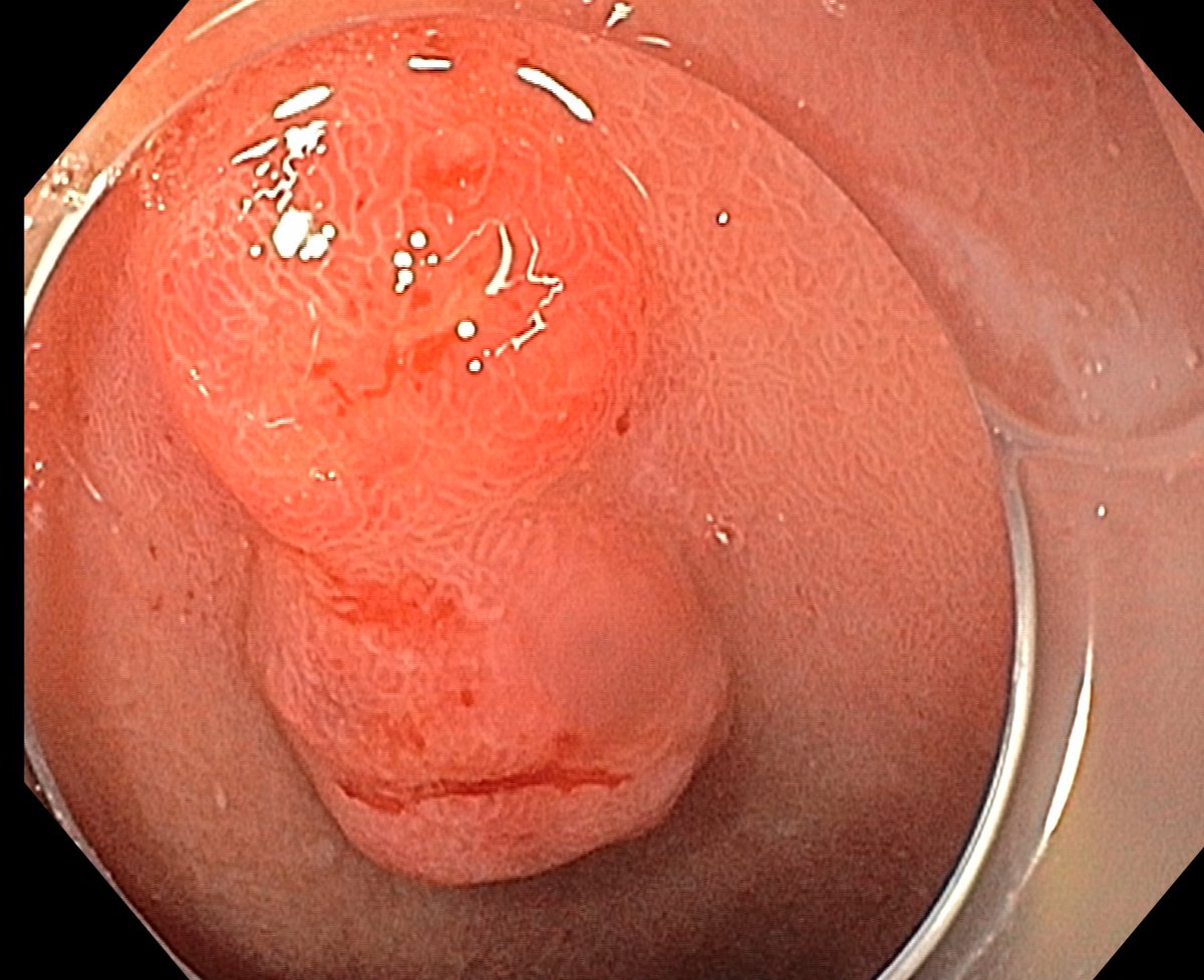 Aleksandar Gavric tweet media