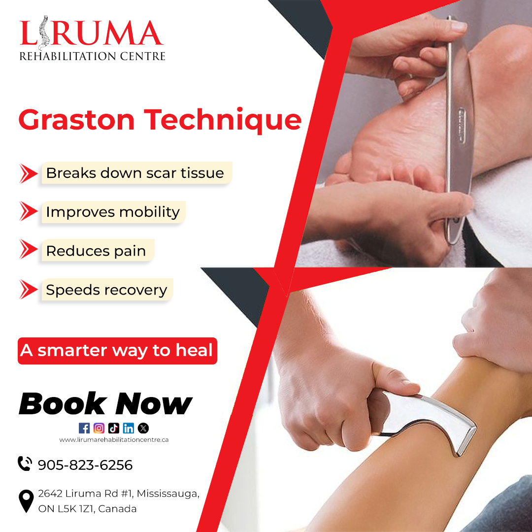 Lirumarehab's tweet image. At Liruma Rehabilitation Centre, we use the Graston Technique to help you move better, recover faster, and live pain-free. This tool-based therapy is safe, effective, and ideal for sports injuries, chronic pain, and mobility issues. 

#LirumaRehab #GrastonTechnique #Physiotherapy
