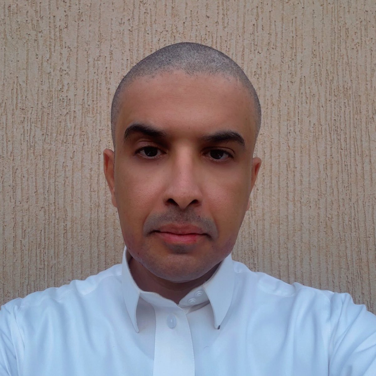 حين أحب السرطان أمي واتجهت للعلاج الكيماوي، تساقط شعرها وتضامنت معها، اليوم بعد أربعة عشر عاما أجدد التضامن معها.
تحية إلى الآنسة العظيمة