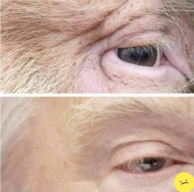 العين الأولى هي عين الخنزير، أما العين الثانية
فهل تعرفون لمن تكون ؟!