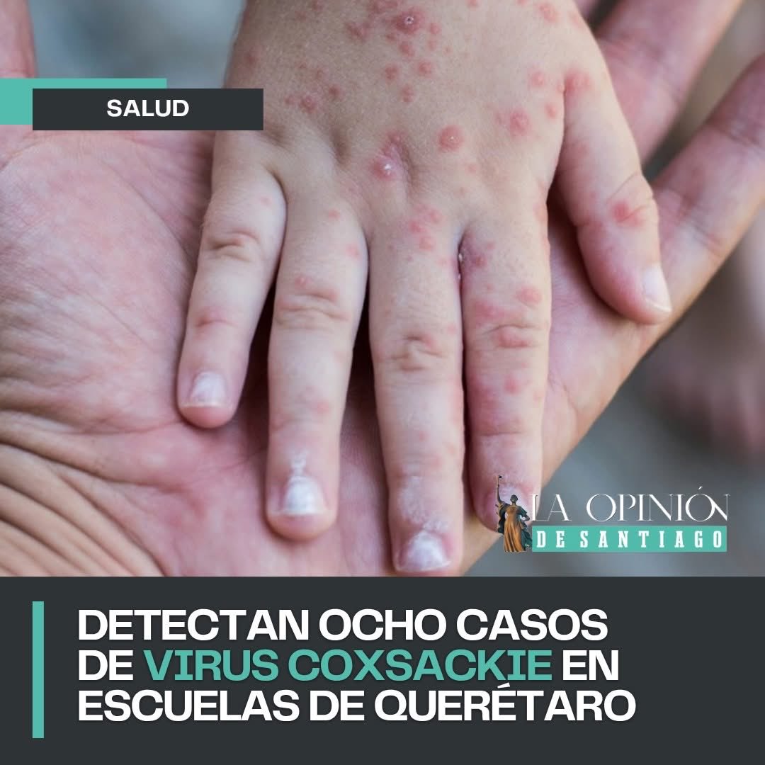 #ATENCION 🚨🦠Ocho estudiantes de la primaria *Mártir de Chihuahua*, ubicada en el centro de 📍 San Juan del Río, resultaron contagiados por el virus Coxsackie, conocido como "manos, pies y boca", confirmó la coordinadora de la #USEBEQ, Irene Quintanar.

FUENTE: MegaNoticias