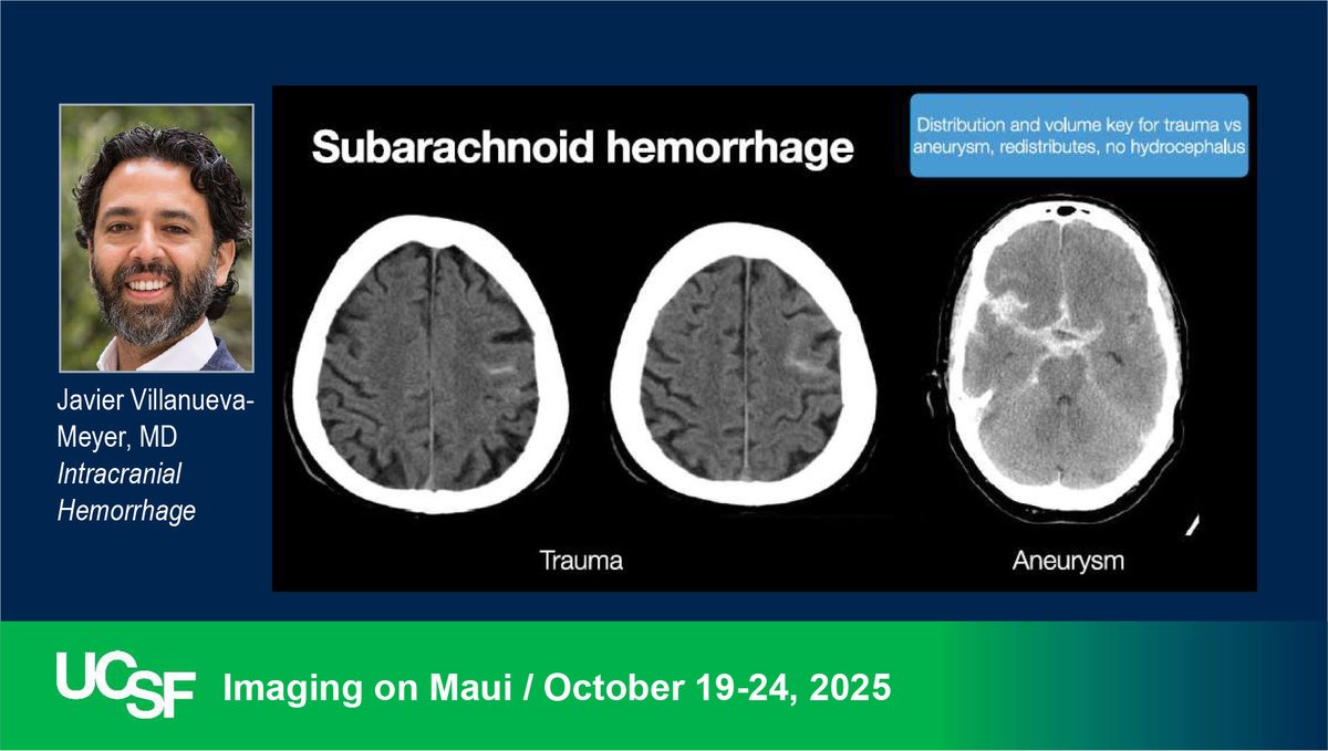UCSF Neuro Faculty Dr. Javier Villenueva-Meyer reviews Intracranial Hemorrhage at our CME course on MAUI. radiology.ucsf.edu/cme