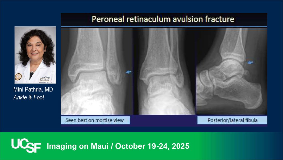 Guest MSK Faculty Dr. Mini Pathria reviews Ankle &amp; Foot at our CME course on MAUI. radiology.ucsf.edu/cme