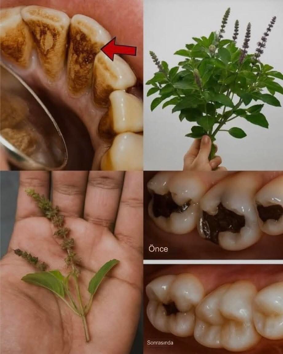 UNUTULAN KADİM BİLGİLERİMİZDEN,

Fesleğen'i (Tulsi) kaynat, Şifayı yudumla! Dişlerini ve diş etlerini güçlendirirken neden atıyorsun?

Doğal olarak çürüklerle savaşır,
Sağlıklı diş etlerini ve taze nefesi destekler,