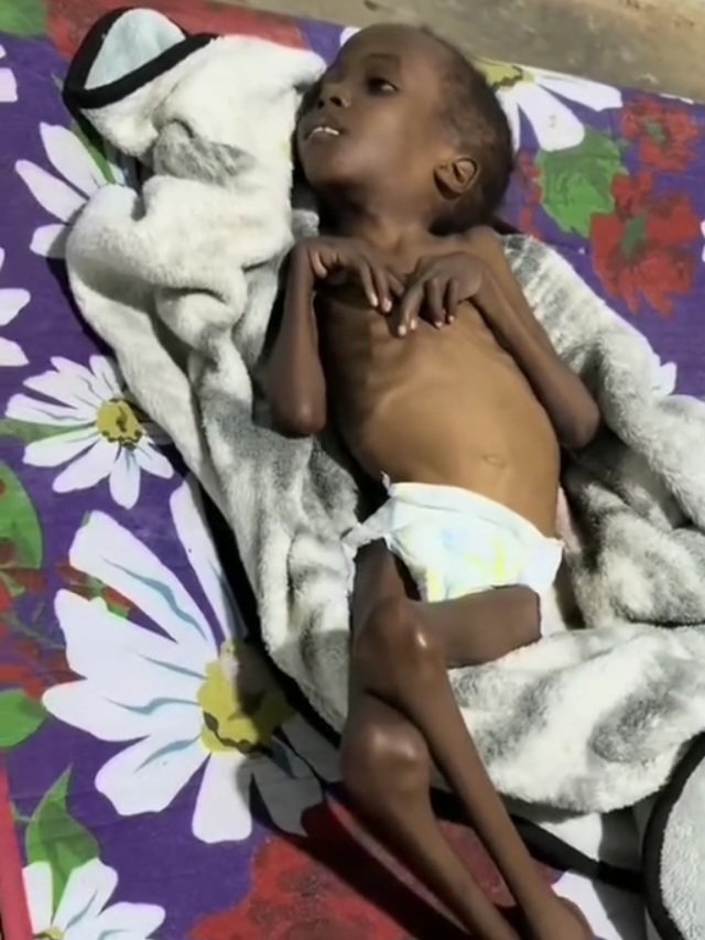 239 طفل ماتوا من الجوع حتى اللحظة في السودان
لا تغفلوا عن قضيتهم... 
#الفاشر_تموت_جوعاً