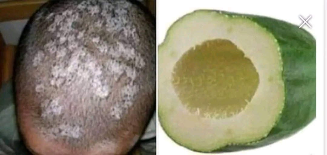 Natural Remedy for Ringworm! 🌿🍃
Why stress over creams when nature heals it fast?

🌿 Unripe papaya kills fungus naturally
🌿 Soothes itching &amp; clears infection
🌿 Safe, simple &amp; effective!

✅ Rub fresh unripe papaya cubes on the affected area. Leave for 15 mins, rinse with