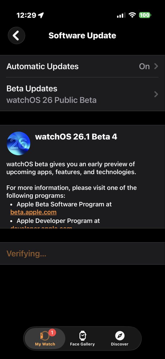 WTF is going on <a href="/Apple/">Apple</a>?!?! I’ve been stuck on this page for going on 17 hours now, even though I’ve recycled my phone and watch THREE TIMES ALREADY!!!