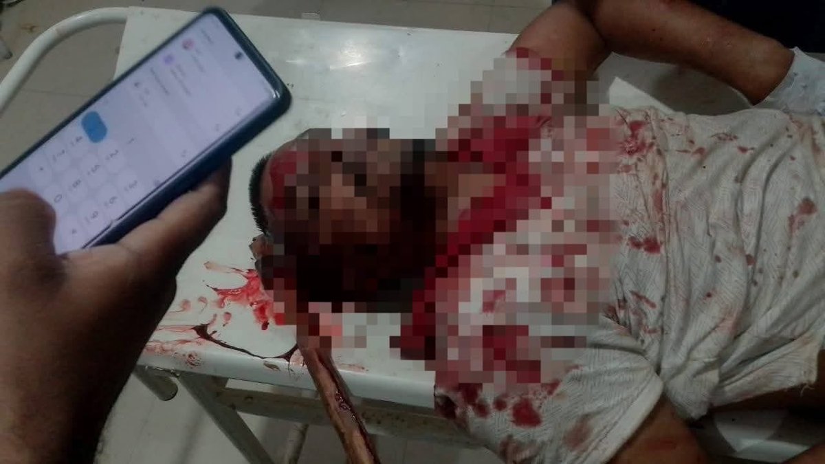 सीधी जिला रामपुर नैकिन थाना खड्डी चौकी रिमारी गांव में ब्राह्मण सूरज मिश्रा की लठ्ठैत ने धारदार हथियारों से निर्मम हत्या कर दी है। 
इस प्रदेश में आज के समय सबसे ज्यादा चौतरफा कोई पीड़ित वर्ग है तो वह है सिर्फ ब्राह्मण...
क्या ब्राह्मण इस देश का नागरिक नहीं है?<a href="/VoiceOfBrahmins/">Voice Of Brahmins</a>
