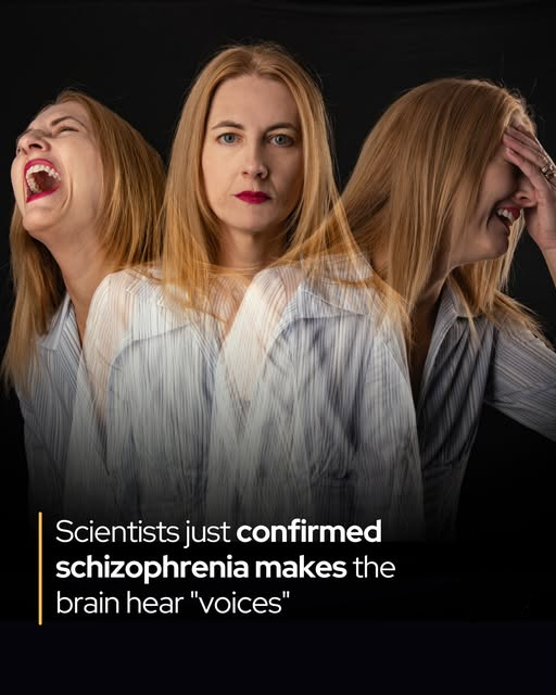 Rainmaker1973's tweet image. 🚨 Confirmed: Schizophrenia’s “voices” are the brain mishearing its own thoughts.
For decades, neuroscientists have theorized that the "voices" heard by individuals with schizophrenia stem from the brain mistaking its own inner dialogue for external sounds. A groundbreaking…