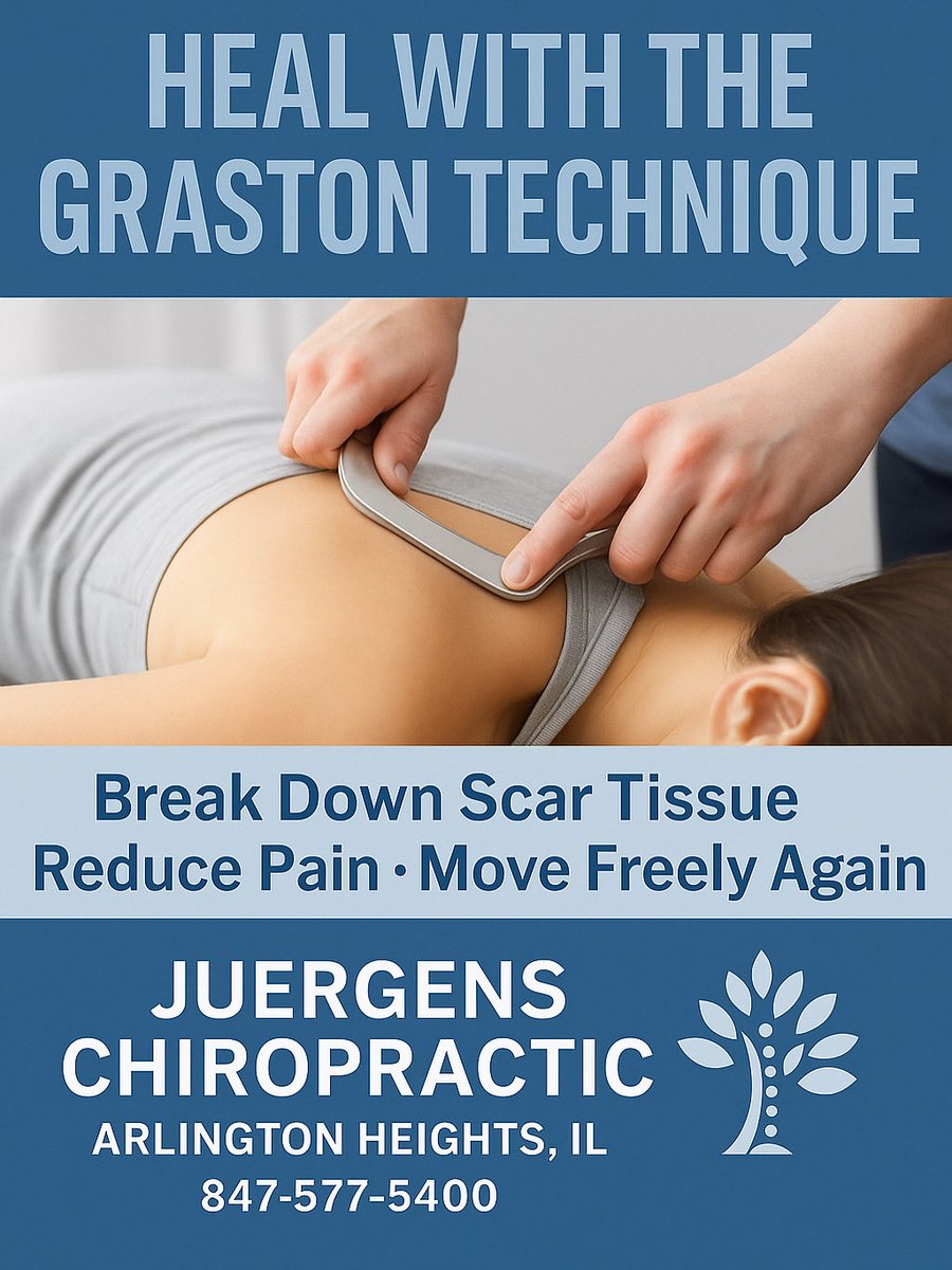 DrJuergensClark's tweet image. Heal faster with the Graston Technique at Juergens Chiropractic.
Break down scar tissue, reduce pain, and move freely again. 💪
📍 Arlington Heights, IL | 📞 847-577-5400
#JuergensChiropractic #GrastonTechnique #PainRelief