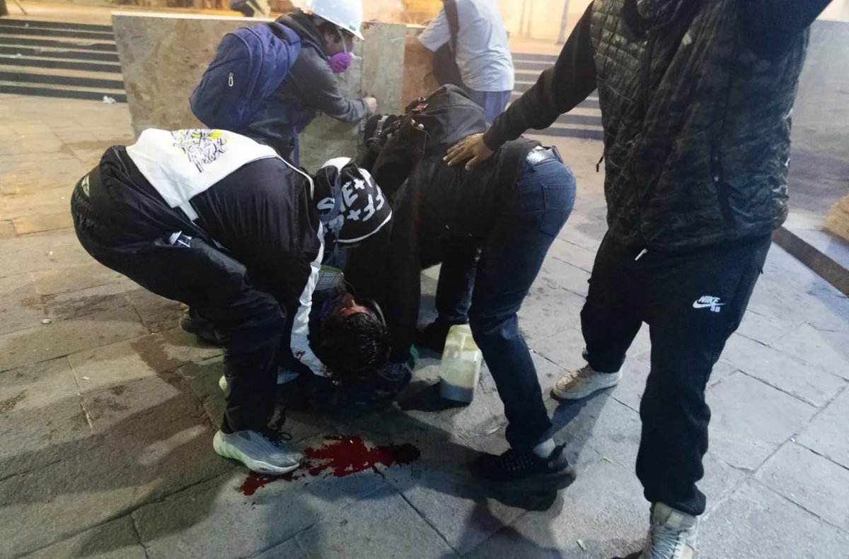 🔴 #URGENTE | Caso ‘Flipown’.

Este podría ser uno de los ‘escopeteros’ responsables que disparó la bomba lacrimógena al rostro del productor musical Roberth Reyes, más conocido como Flipown, que lo dejó en coma producto de una fractura en el rostro y zona parietal,