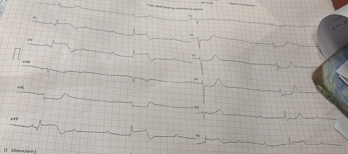 Vighnesh Rane tweet media