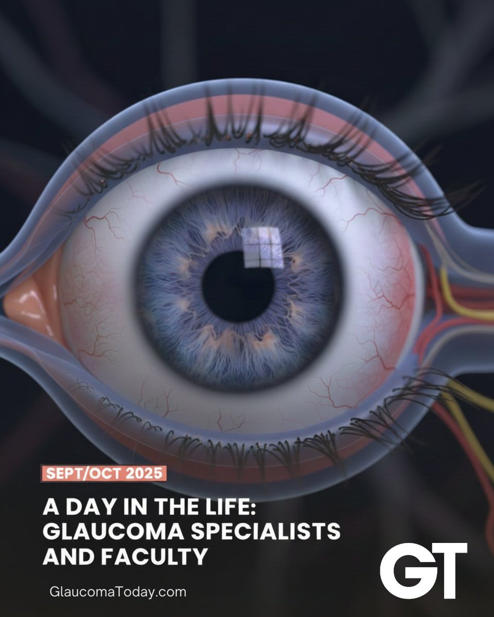 Recognize familiar scenarios? Our article, 'A Day in the Life: Glaucoma Specialists,' offers a glimpse into the clinical and academic worlds of glaucoma. A must-read for insights on shared challenges: ow.ly/7xsG50XgwtM