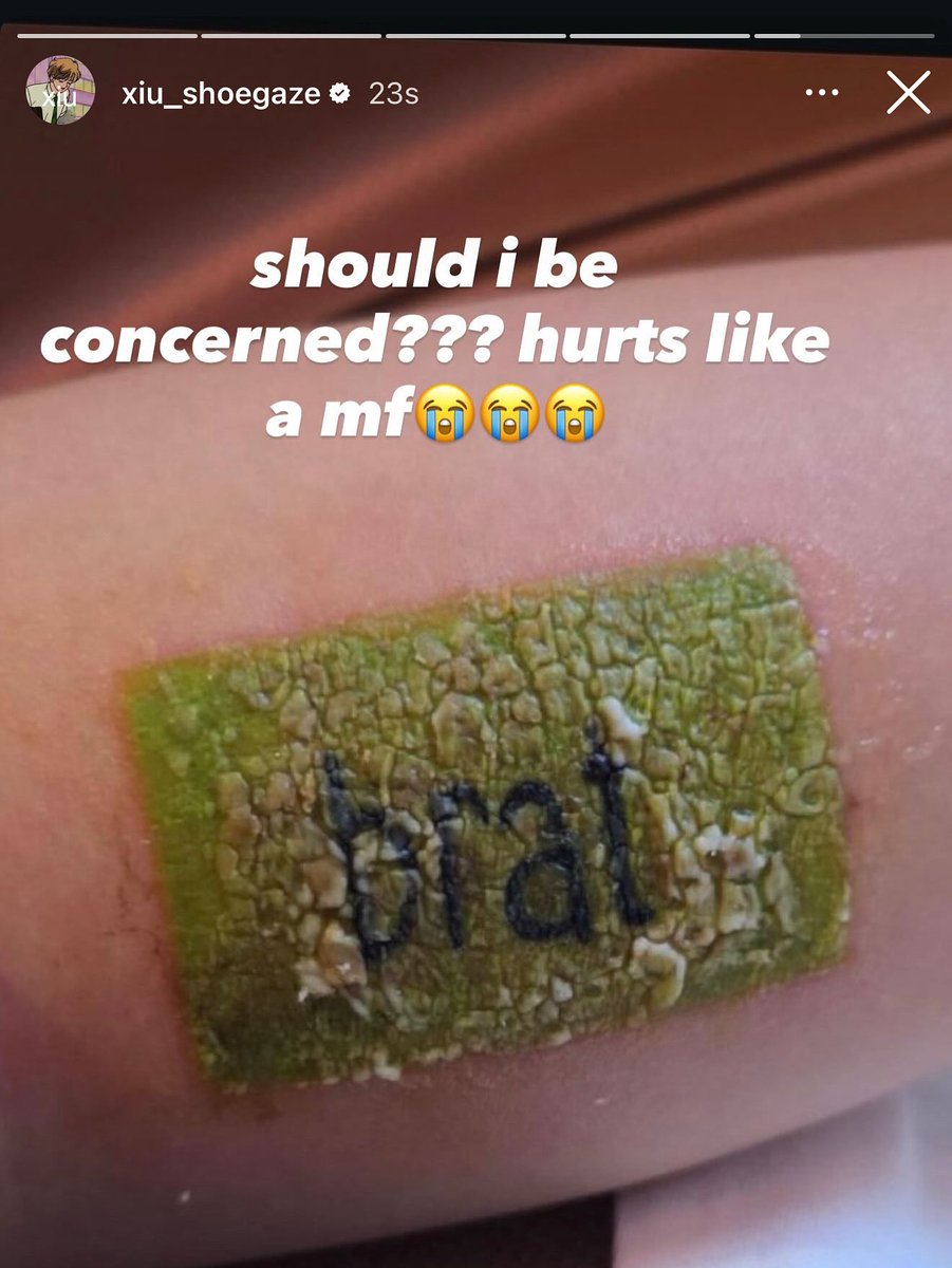 xiu_shoegaze's tweet image. on the bright side i think it’ll leave a badass scar ^_^