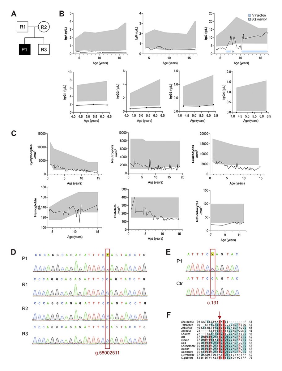 jhumimmunity's tweet photo. New study from @ValagussaAlice, Kracker et al. @Inserm identifies and characterizes a novel heterozygous USB1 variant (p.P44L) in a patient with #hypogammaglobulinemia and low #neutrophil counts, showing altered protein localization and function. https://t.co/5K0yoDYFZr https://t.co/7f2uz0B3ni