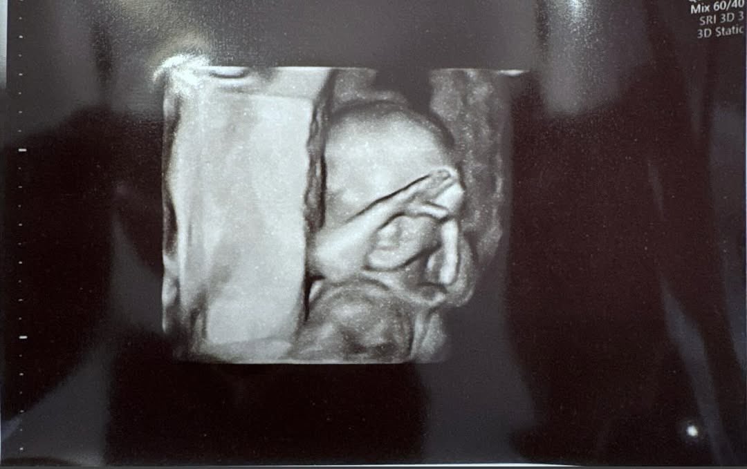 Yeeting at #16weeks is crazy 😂🤪 <a href="/WWEUsos/">The Usos</a> #babyfatu