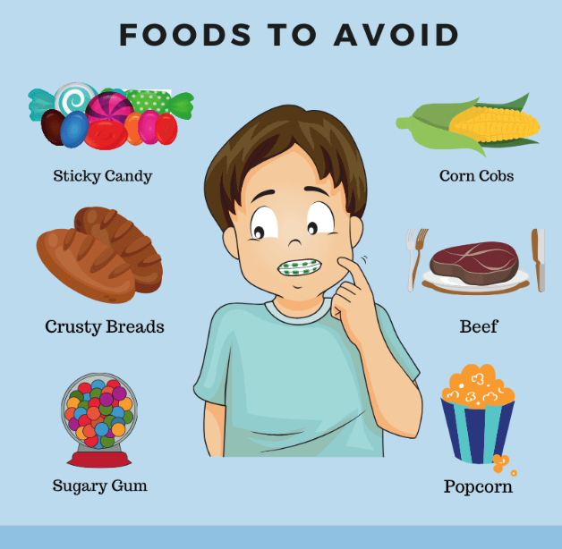 drdrumi's tweet photo. 🦷Avoid chewing corn, ribs, and nuts while wearing braces. Hard foods can easily damage your braces. 🌽🦷 #dentalcare #protectteeth #popularscience https://t.co/xjOXQyct9x