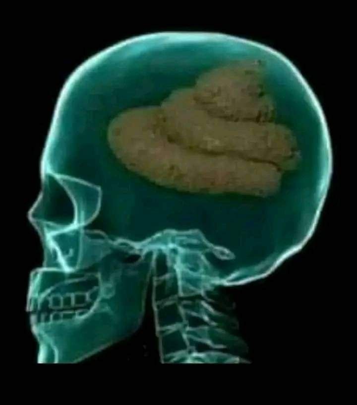 LucasSi16091011's tweet photo. @MemesContraban eu tentando entender a coerência dessa comparação. https://t.co/gn4sJYeU7N