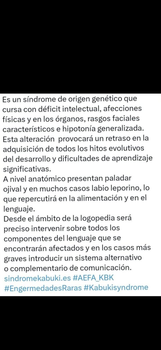 LOGOMEDIA2's tweet image. 23 de octubre 
Día Mundial del SíNDRoMe de KaBuKi 
@sindromekabuki.es #AEFA_KBK
#enfermedadesraras #kabukisyndrome