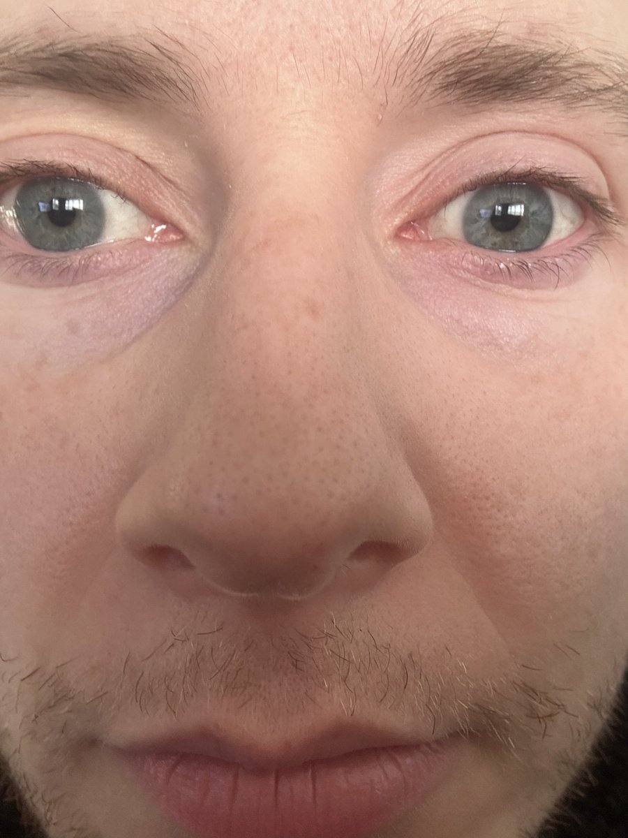 The nationality                                                The face