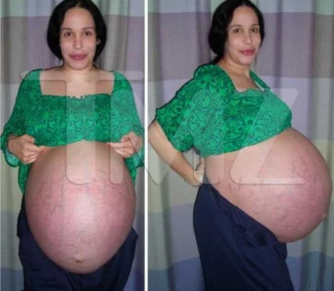 I hope Octomom is doing ok.