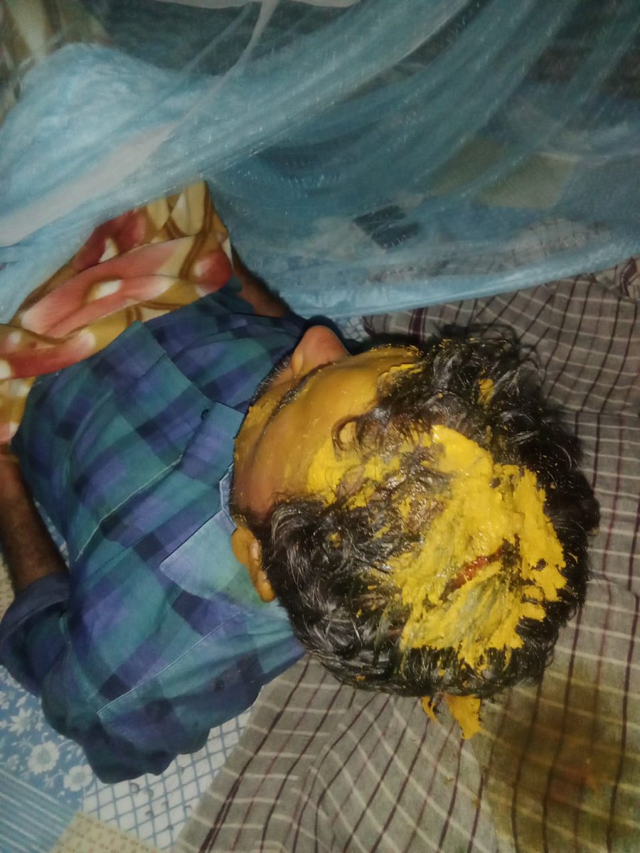 विक्रम विशुनपुर के रहने वाले शेषमणी पटेल जो रामपुर गौनरिया में अपनी दुकान चलाते हैं 17 अक्टूबर को इनके ऊपर जानलेवा हमला हुआ लेकिन महुआडीह थाना दोषियों के ऊपर करवाई करने के बजाय मामले को सुलह करने का दबाव बना रहा है <a href="/dmdeoria/">DM Deoria</a> <a href="/DeoriaPolice/">DEORIA POLICE</a> <a href="/AdgGkr/">ADG ZONE Gorakhpur</a> <a href="/diggorakhpur/">DIG Range Gorakhpur</a>