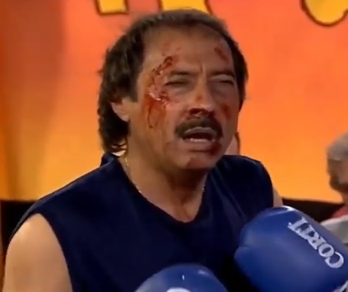 soyunargento's tweet image. Santi Sosa después del codazo de Marcos Rojo
