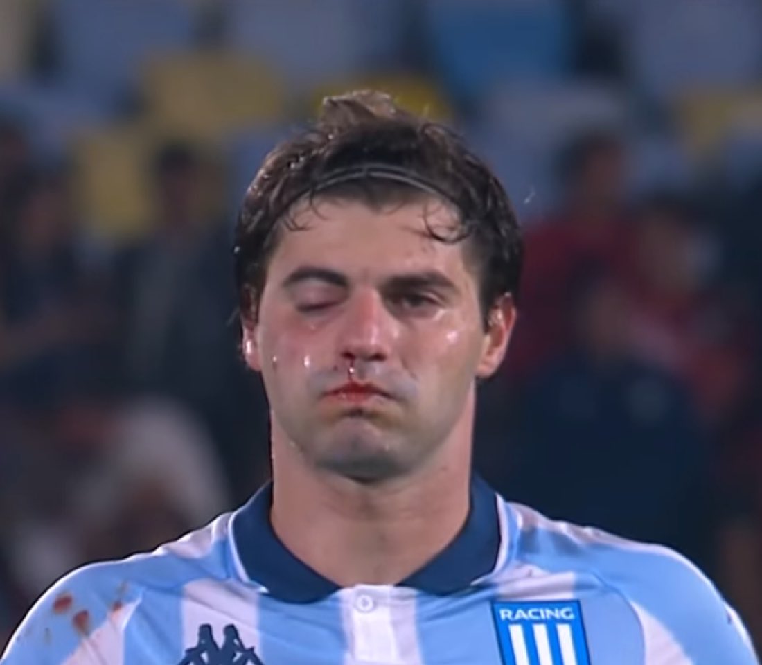 0800Cj's tweet photo. Pidio un hijo de puta? 

▫️Roja estando en el banco 
▫️Gol en contra
▫️Arruino al compañero https://t.co/jxmbebYMRE