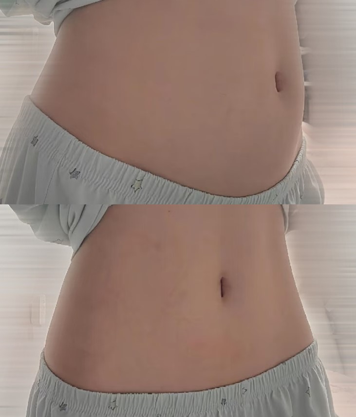 ナナティーナページ ナナ (@__o0nan) / Posts / X