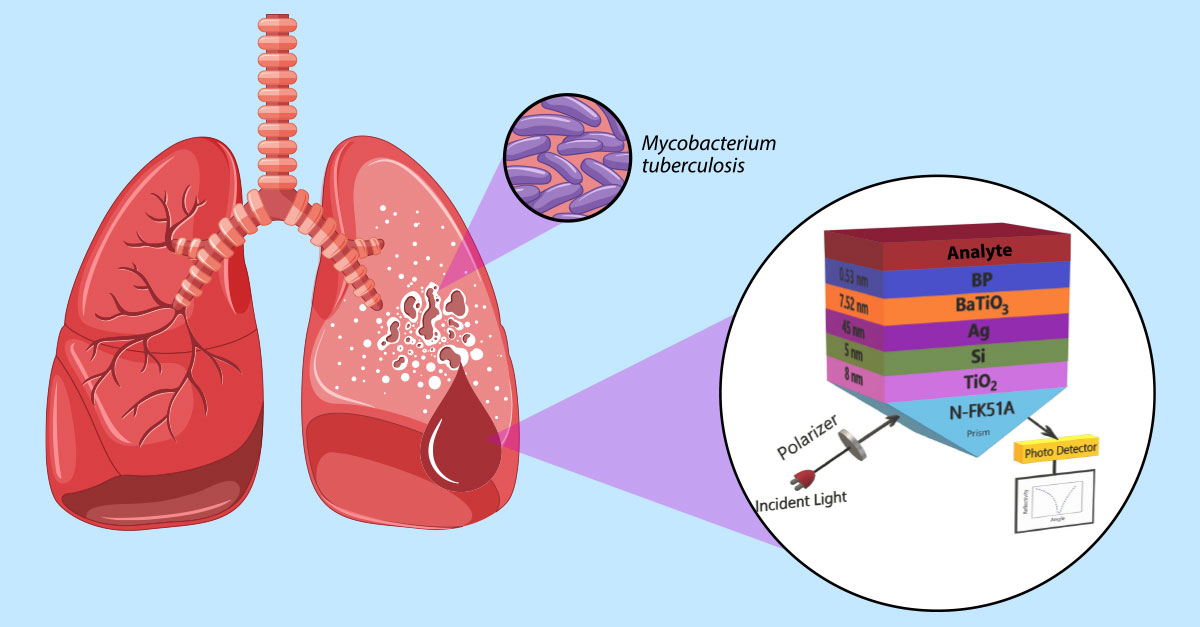 sensorsalert's tweet image. Researchers have developed a new, highly sensitive surface plasmon resonance #SPR #biosensor to detect #tuberculosis! The sensor uses black phosphorus to enhance performance and sensitivity.

For more updates, subscribe to our weekly emailer: ieee-sensorsalert.org
