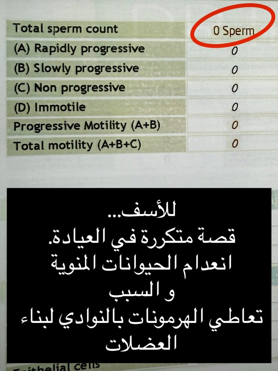 استخدام هرمون التستوستيرون لبناء العضلات قد يعطي شكل مؤقت، لكنه يوقف إنتاج الهرمون الطبيعي ويؤثر سلبًا على خصوبة الرجل.
📉 انخفاض عدد الحيوانات المنوية
⚠️ ضعف إنتاج الخصيتين

<a href="/Masalek_kw/">عيادة مسالك</a> 
#عيادة_مسالك
