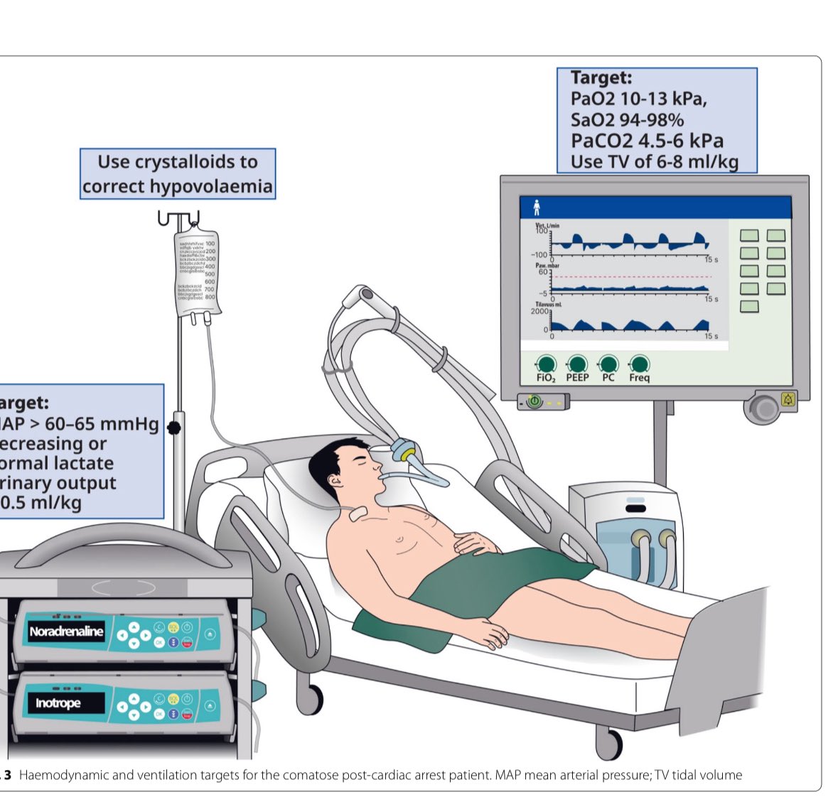 chiara_robba's tweet image. New Guidelines for post resuscitation care after cardiac arrest 

doi.org/10.1007/s00134…