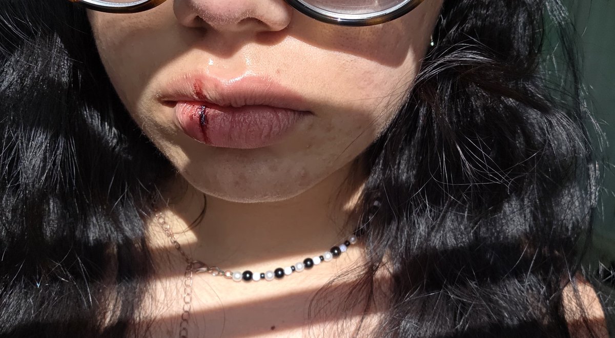 toastwitnobread's tweet photo. lip cut i hope none of my irls see this 🙏🙏 https://t.co/yULvJlqDQk