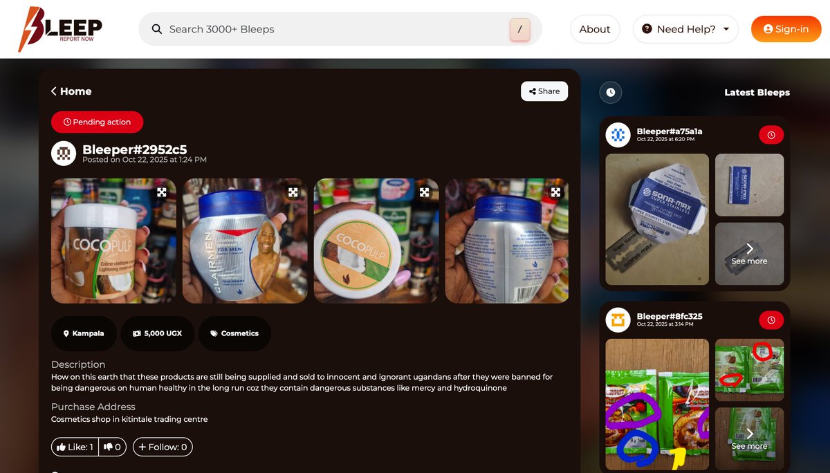 🚫𝐑𝐞𝐦𝐢𝐧𝐝𝐞𝐫: Skin bleaching creams which contain 𝐇𝐲𝐝𝐫𝐨𝐪𝐮𝐢𝐧𝐨𝐧𝐞 and 𝐌𝐞𝐫𝐜𝐮𝐫𝐲 are 𝐛𝐚𝐧𝐧𝐞𝐝 𝐢𝐧 𝐔𝐠𝐚𝐧𝐝𝐚.

As a customer, it's important to be cautious when purchasing cosmetic products from the market. Only buy products from 𝐫𝐞𝐥𝐢𝐚𝐛𝐥𝐞 and