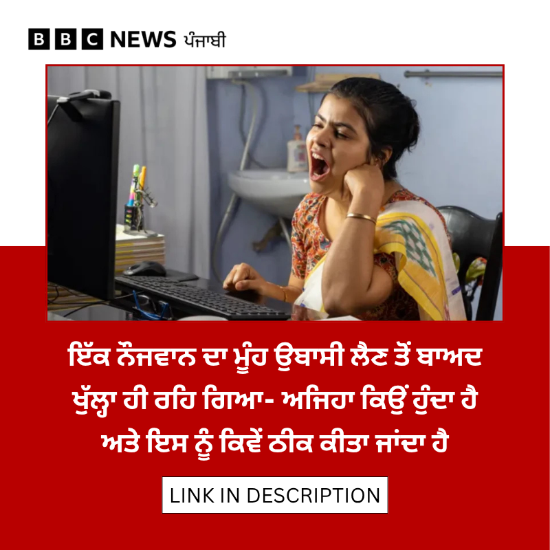 bbcnewspunjabi's tweet photo. ਉਬਾਸੀ ਲੈਣ ਵੇਲੇ, ਮੂੰਹ ਭਰ ਕੇ ਖਾਣਾ ਖਾਣ ਵੇਲੇ ਜਾਂ ਕਈ ਹੋਰ ਸਥਿਤੀਆਂ 'ਚ ਕੁਝ ਲੋਕਾਂ ਦਾ ਜਬਾੜਾ ਲੌਕ ਹੋ ਜਾਂਦਾ ਹੈ, ਪਰ ਅਜਿਹਾ ਕਿਉਂ ਹੁੰਦਾ ਹੈ? ਸਮੱਸਿਆ ਵੇਲੇ ਡਾਕਟਰੀ ਸਹਾਇਤਾ ਨਾ ਮਿਲੇ ਤਾਂ ਕੀ ਕਰੀਏ?
Read: https://t.co/P6rOQTJcD6
#jawlock #health https://t.co/l6ZAU3Kq19