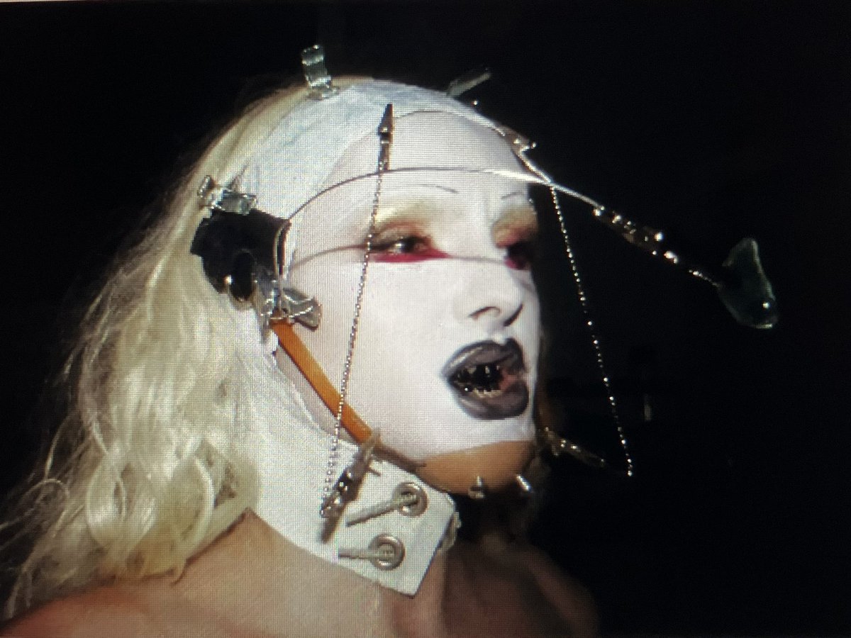 corrección mandibular 

(nuevo looket todo hecho por mi como siempre precaria espero os guste)