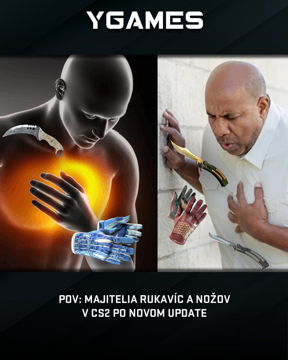 Nepríjemné ranné prekvapko...🤕 #cs2