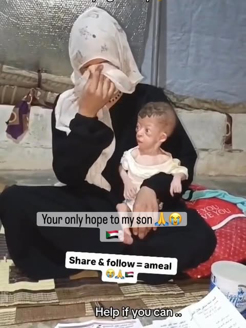 yasminemuhamsd's tweet image. We are not ghosts, we are living humans. Please don’t ignore us — my child needs medicine, and we deserve a chance to live.

If you are scrolling please leave a comment chuffed.org/project/152073…