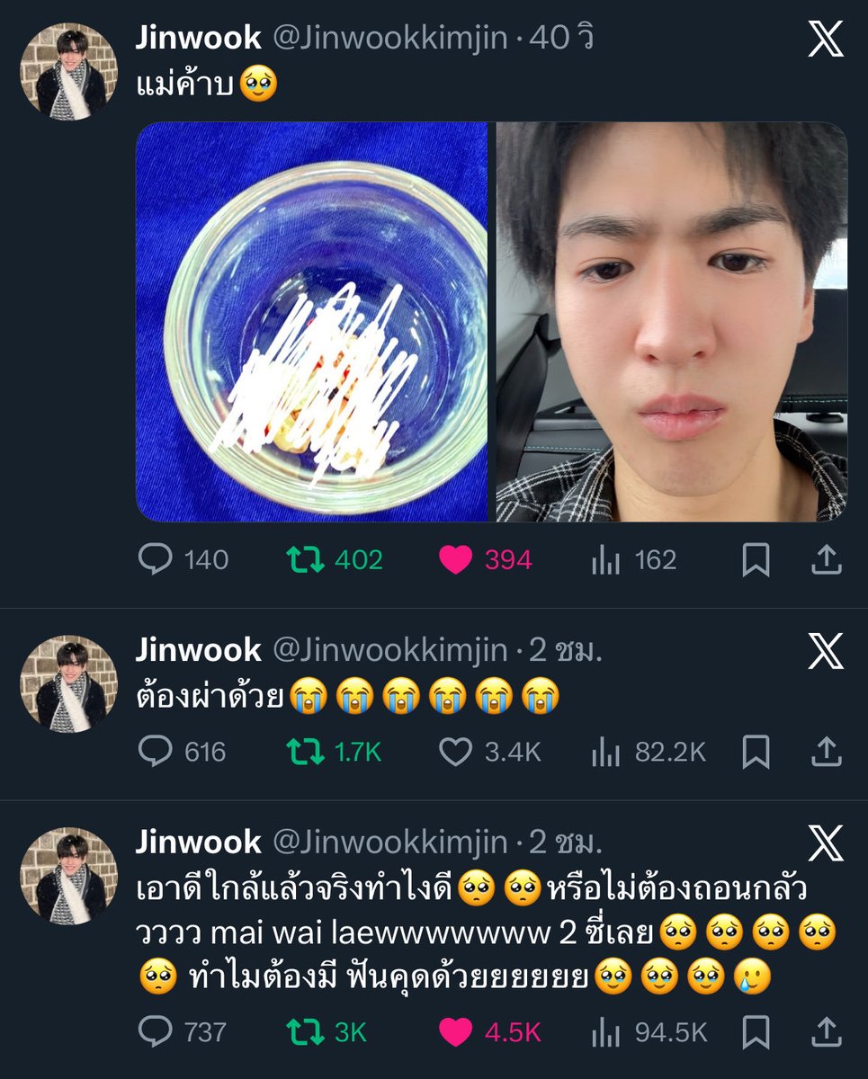 จั้นเอ็นดูมากกกกก ตั้งแต่เมื่อคืน ตอนเช้า ยันถอนเสร็จ รายงานทุกชั่วโมงเลย บุคคลที่ชาวเน็ตเอาใจช่วยในการถอนฟันจริงๆ😂🥹