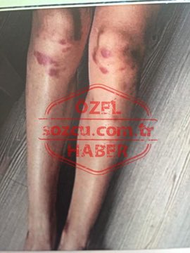 Deniz Bulutsuz'a şiddet uygulayan Ozan Güven'in cezası onandı: 45 gün cezaevine girecek !!! Ne !!!
#sondakika #perşembe #haber