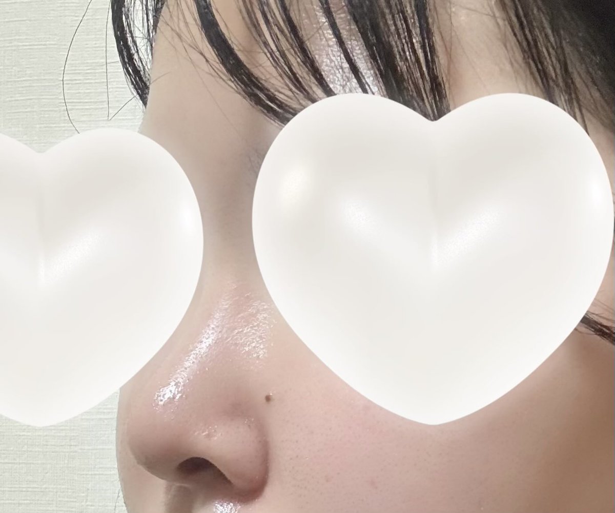 ビギンのイジュチョル院長に鼻フル貴族(肋軟骨)をしてもらって2ヶ月経ちました❣️
自然でキュートなお鼻になれて感動です😭💞

DMにて質問受け付けております💌
#ビギン美容外科 #鼻整形 #鼻フル