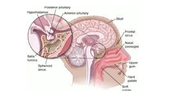 Decoding Brain Tumors: A Guide to Pituitary Tumors in Kolkata - apsense.com/article/863788…

#pituitarybraintumors #transnasal #pituitarytumor #pituitarytumors #TransnasalSurgery #pituitarybraintumor #VisionRecovery