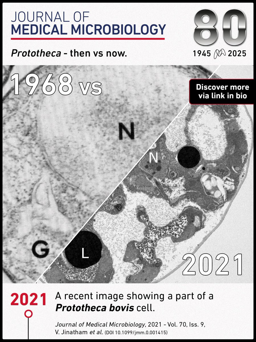 MicrobioSoc's tweet image. Technological advances, like the improvement of visualisation techniques, have been vital to the advancement of microbiology. Compare these #JMedMicro visualisations of Prototheca species from 1968 and 2021 - doi.org/10.1099/jmm.0.…