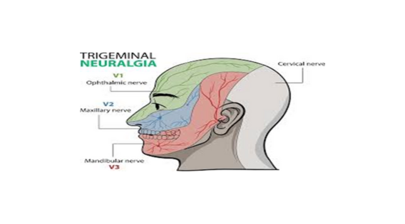 Kolkata's Renowned Neurosurgeons: Pioneering Trigeminal Neuralgia Treatment - apsense.com/article/862049…

#trigeminalneuralgia #trigeminalneuralgiaspecialist #trigeminalneuralgiatreatment #TrigeminalNeuralgiaAwareness #TheSuicideDisease #neurosurgeon #neurosurgery