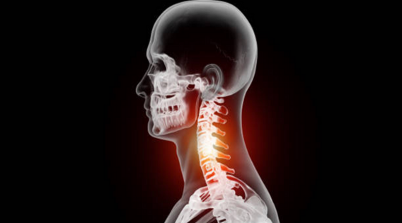 Cervical Spine Injuries: Prevention, Treatment, and Recovery - apsense.com/article/859370…

#CervicalSpineSurgeon #cervicalspineneurosurgeon #cervicalspinesurgery #DiscReplacementSurgery #cervicaldiscreplacement #cervicalspinesurgery