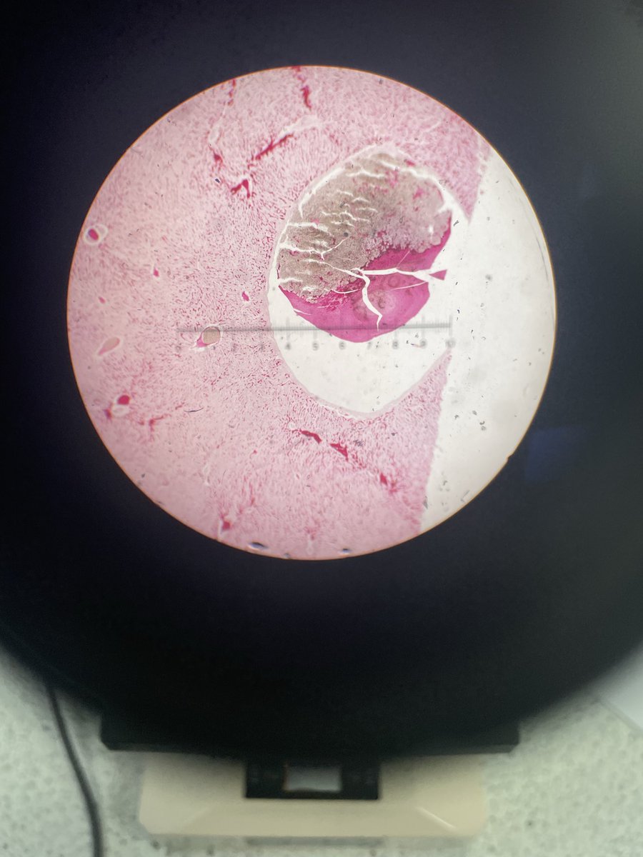 hikkichaeri1812's tweet image. photos liver cells under a microscope from biology