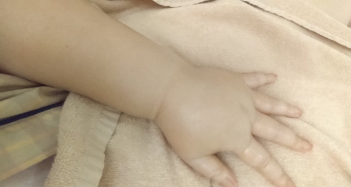 ほんとに浮腫をとる方法はないの？